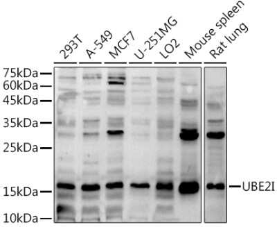 Western Blot: UBE2I/Ubc9 Antibody [NBP2-93799] - Western blot analysis of extracts of various cell lines, using (NBP2-93799) at 1:1000 dilution. Secondary antibody: HRP Goat Anti-Rabbit IgG (H+L) at 1:10000 dilution. Lysates/proteins: 25ug per lane. Blocking buffer: 3% nonfat dry milk in TBST. Detection: ECL Basic Kit. Exposure time: 30s.